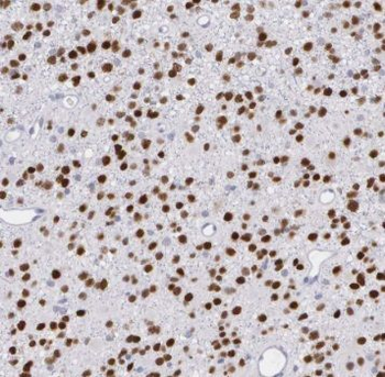 TSNAX Rabbit Polyclonal Antibody