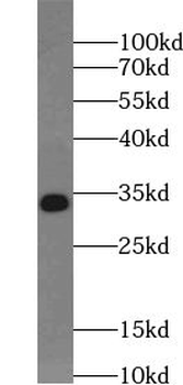 TSPAN7 Rabbit Polyclonal Antibody