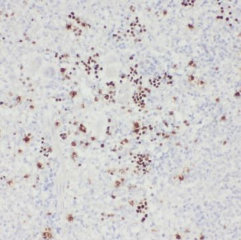 TSPAN7 Rabbit Polyclonal Antibody