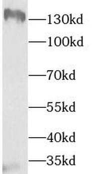 TTBK2 Rabbit Polyclonal Antibody