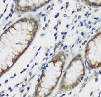 TTBK2 Rabbit Polyclonal Antibody