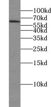 TTC39B Rabbit Polyclonal Antibody