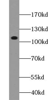 TUBGCP5 Rabbit Polyclonal Antibody
