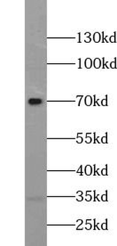 TULP1 Rabbit Polyclonal Antibody