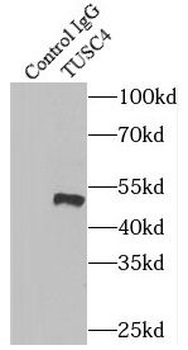 NPRL2 Rabbit Polyclonal Antibody