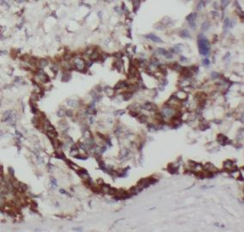 NPRL2 Rabbit Polyclonal Antibody