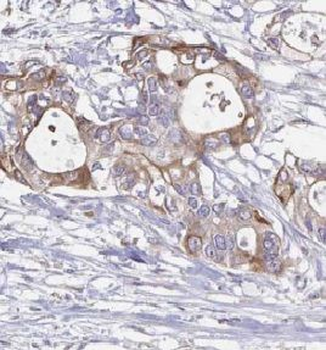 TWF1 Rabbit Polyclonal Antibody