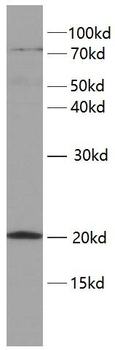 TWIST2 Antibody