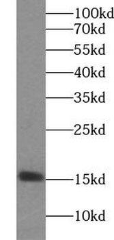 TXNDC17 Rabbit Polyclonal Antibody