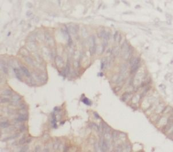 TXNDC5 Antibody