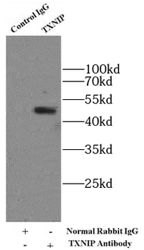 TXNIP Antibody