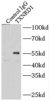 TXNRD1 Antibody