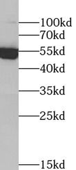 TXNRD2 Rabbit Polyclonal Antibody
