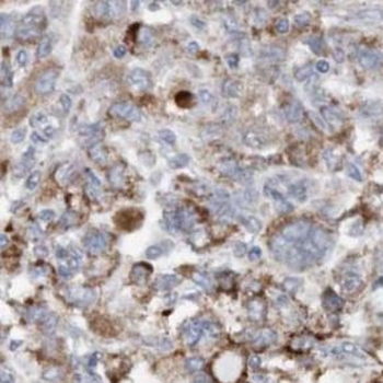 TXNRD2 Rabbit Polyclonal Antibody
