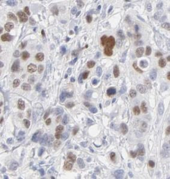 DDX39B Rabbit Polyclonal Antibody