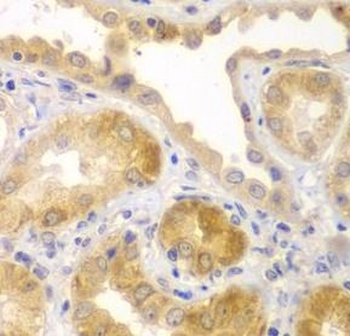 UBA6 Rabbit Polyclonal Antibody