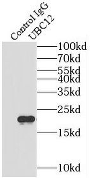 UBE2M Antibody