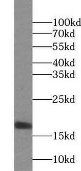 UBE2N Antibody
