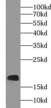 UBE2I Rabbit Polyclonal Antibody