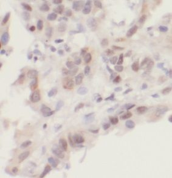 UBE2I Rabbit Polyclonal Antibody