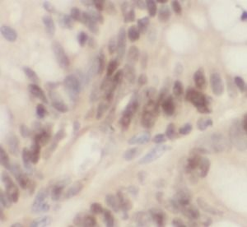 UBD Rabbit Polyclonal Antibody