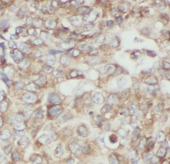 UBE2D4 Antibody