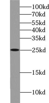 UBE2E3 Rabbit Polyclonal Antibody
