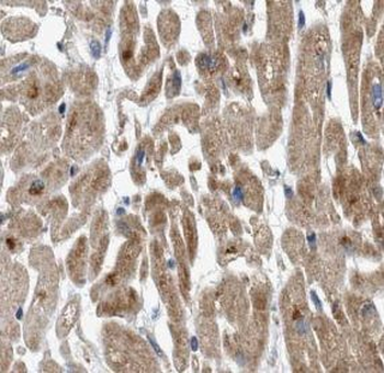 UBE2E3 Rabbit Polyclonal Antibody