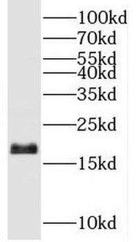 UBE2G2 Antibody