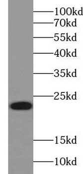 UBE2H Antibody