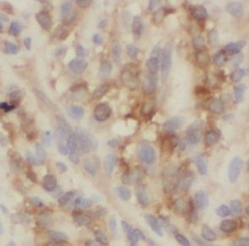 UBE2H Antibody