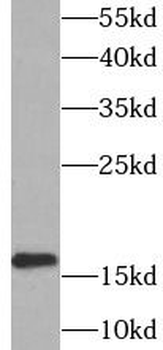 UBE2L3 Rabbit Polyclonal Antibody