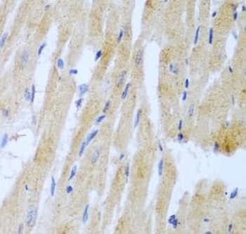 UBE2L3 Rabbit Polyclonal Antibody