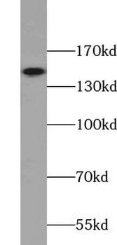 UBE2O Rabbit Polyclonal Antibody