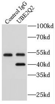 UBE2Q2 Rabbit Polyclonal Antibody