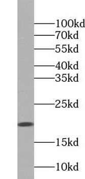UBL4A Rabbit Polyclonal Antibody