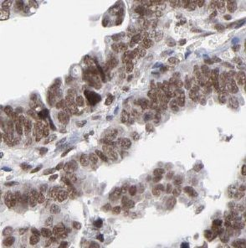 UBLCP1 Rabbit Polyclonal Antibody