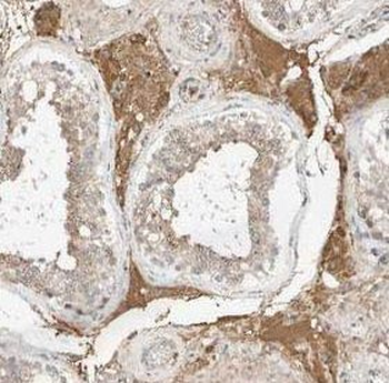 UBQLN2 Rabbit Polyclonal Antibody