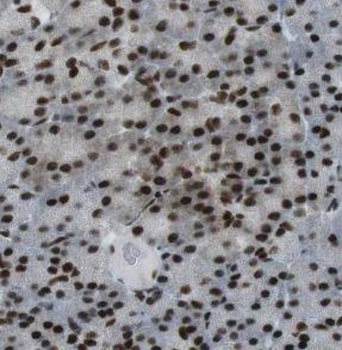 UBR2 Antibody