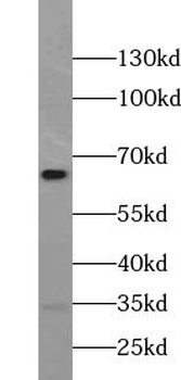 UBXN4 Rabbit Polyclonal Antibody