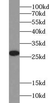 UCHL1 Antibody