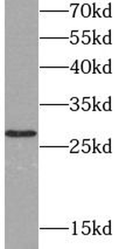 UCHL3 Rabbit Polyclonal Antibody