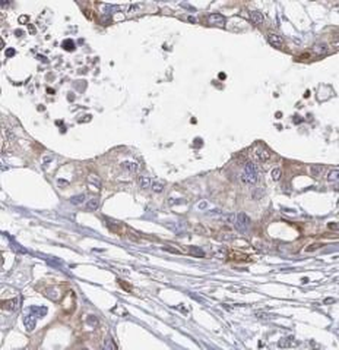 UCHL3 Rabbit Polyclonal Antibody