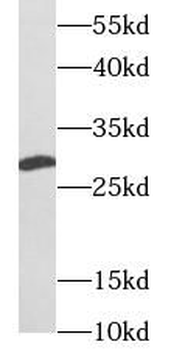 UCP2 Rabbit Polyclonal Antibody