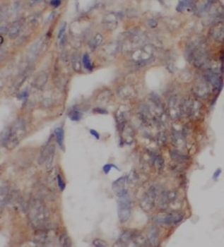 UCP2 Rabbit Polyclonal Antibody