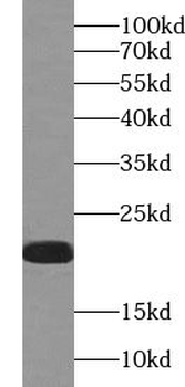 UFC1 Rabbit Polyclonal Antibody