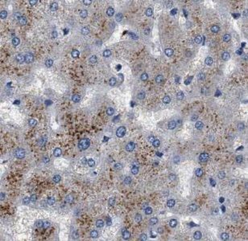 UFC1 Rabbit Polyclonal Antibody