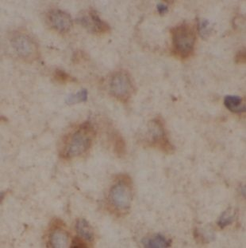 UGT8 Rabbit Polyclonal Antibody