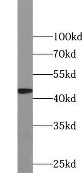 UHMK1 Rabbit Polyclonal Antibody