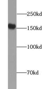 ULK1 Rabbit Polyclonal Antibody